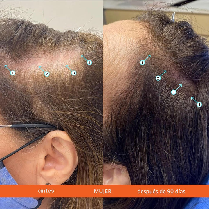 DS Labs Revita Hair Density Champú y acondicionador para cabello ad...
