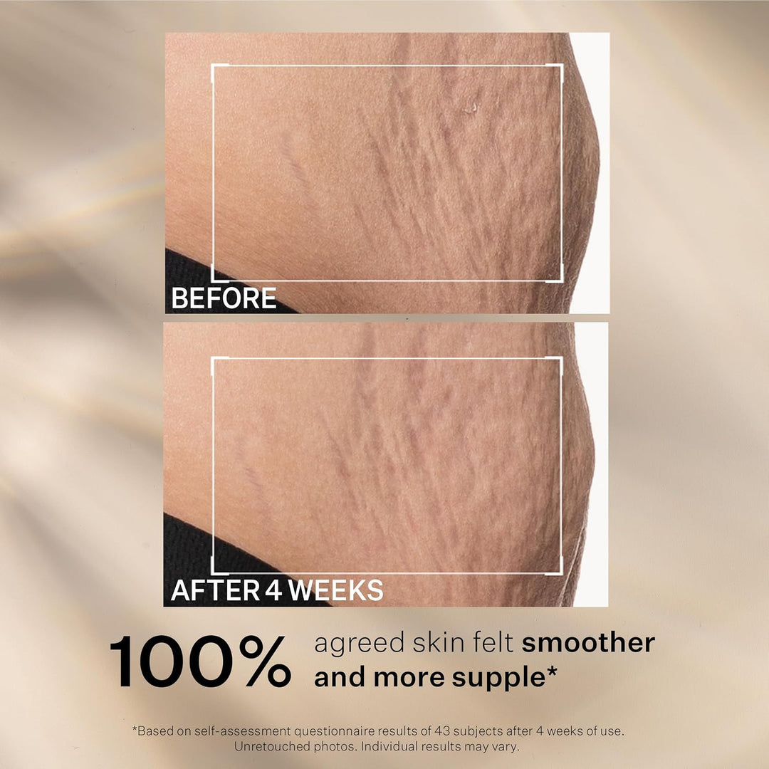 StriVectin SD Advanced Plus Hidratante Intensivo para Arrugas y Est...