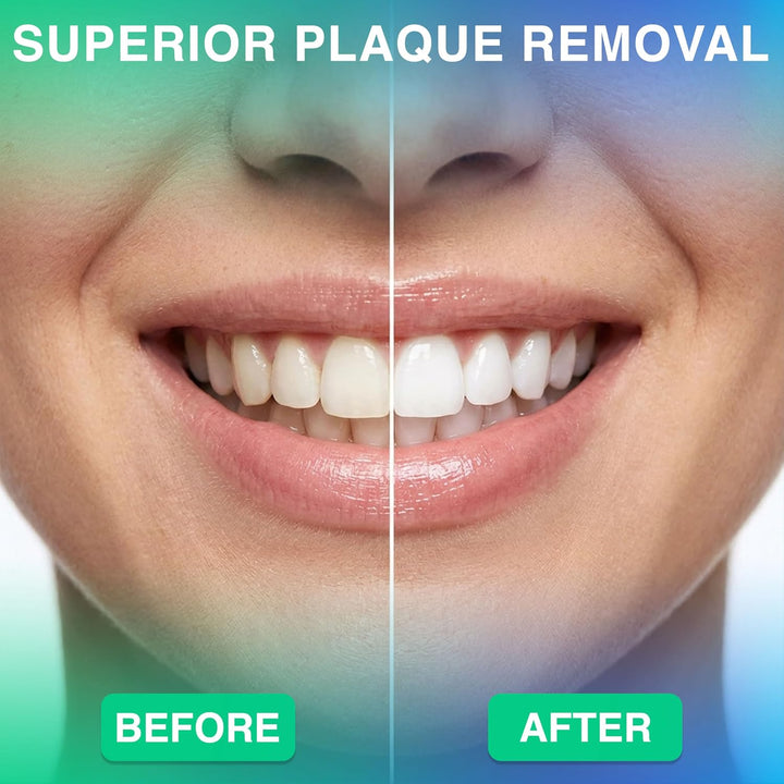Irrigador dental profesional \u2013 Cuidado dental avanzado para un...