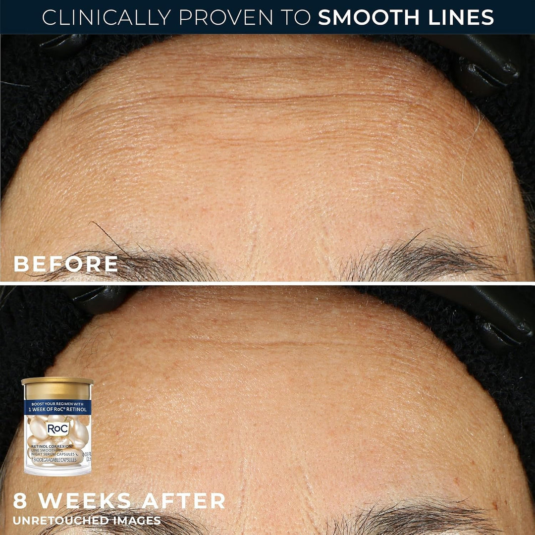 RoC Clinical Mini Retinol Kit de rutina para el cuidado de la piel...