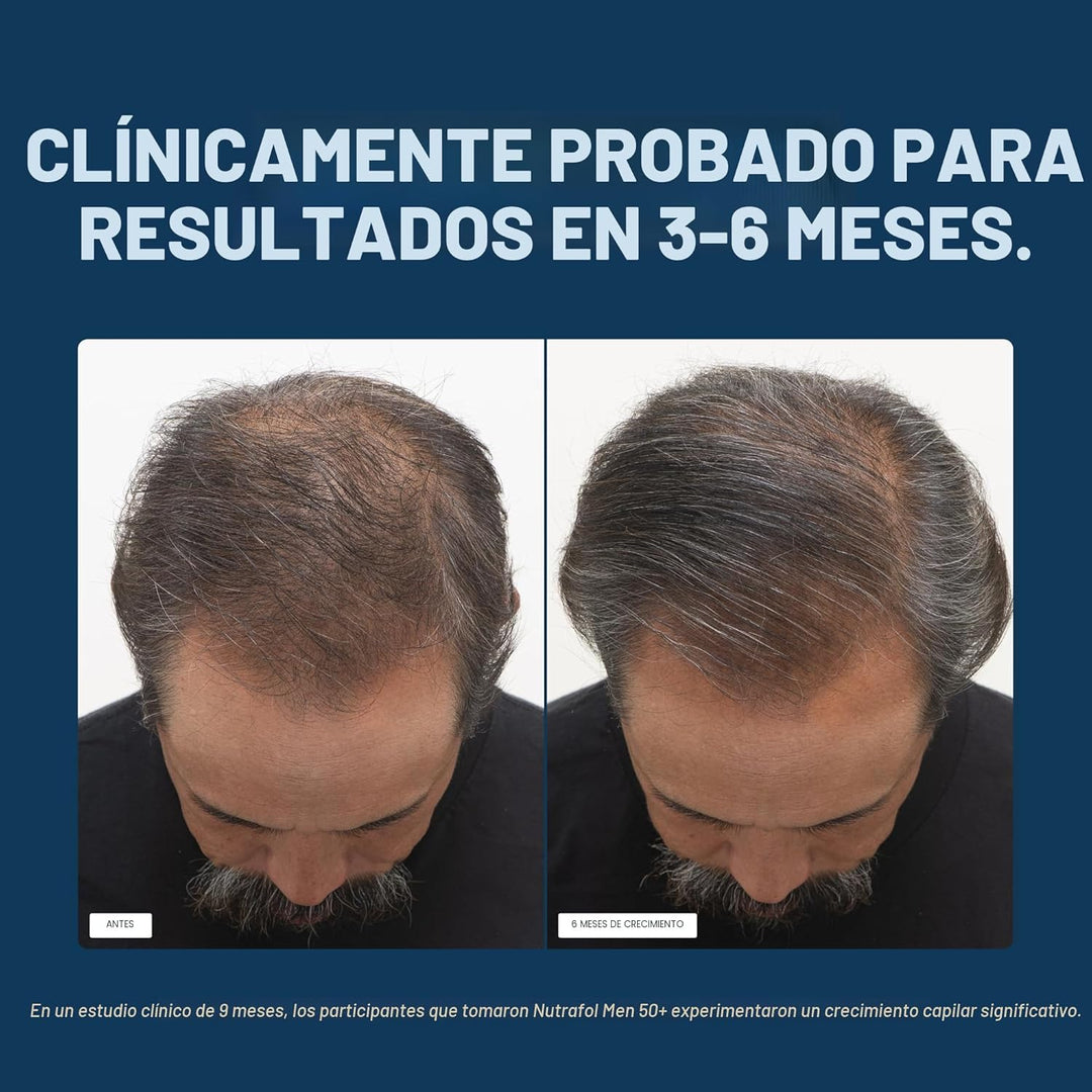 Nutrafol Suplementos para el crecimiento del cabello para hombres d...