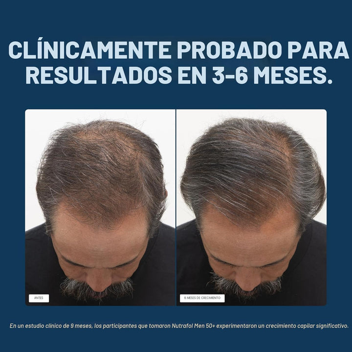 Nutrafol Suplementos para el crecimiento del cabello para hombres d...