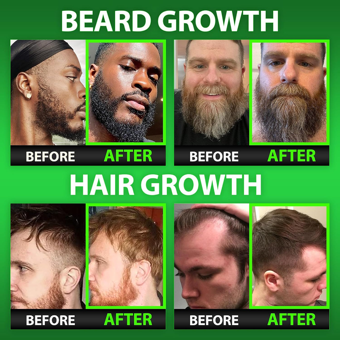 GROW - Suero de aceite para barba + gomitas de biotina para el crec...
