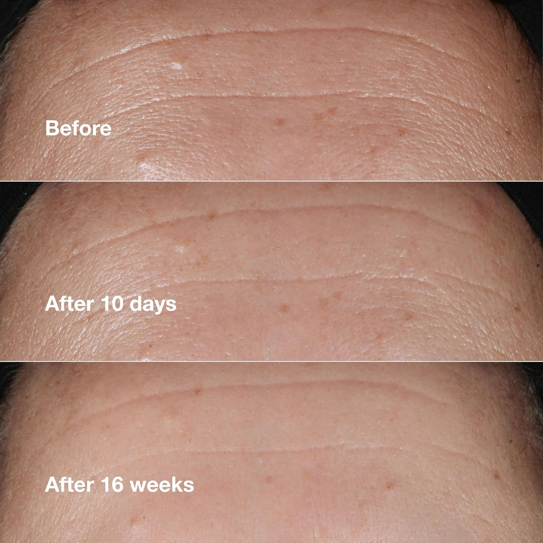 Clinique Smart Clinical Repair Suero facial antienvejecimiento corr...