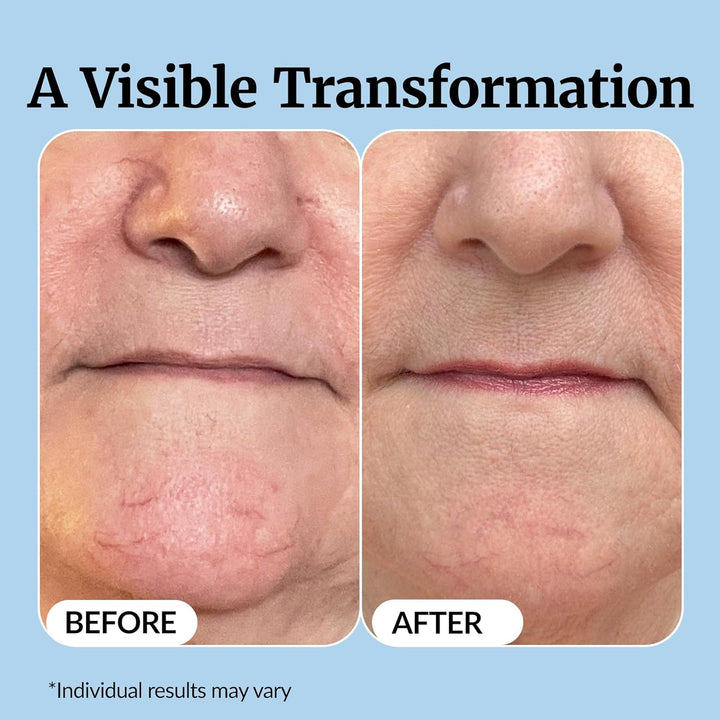 Vibriance Super C Serum para piel madura, fórmula vitamínica todo e...