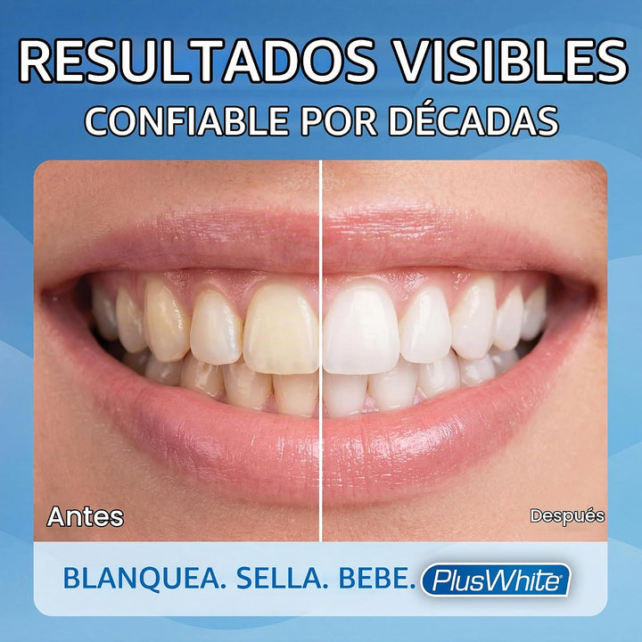 Plus White Gel blanqueador Premier Speed de 5 minutos, 2.0 onzas...