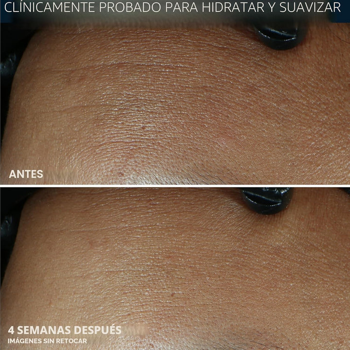 RoC Retinol Correxion Max Hidratación diaria hidratante facial anti...