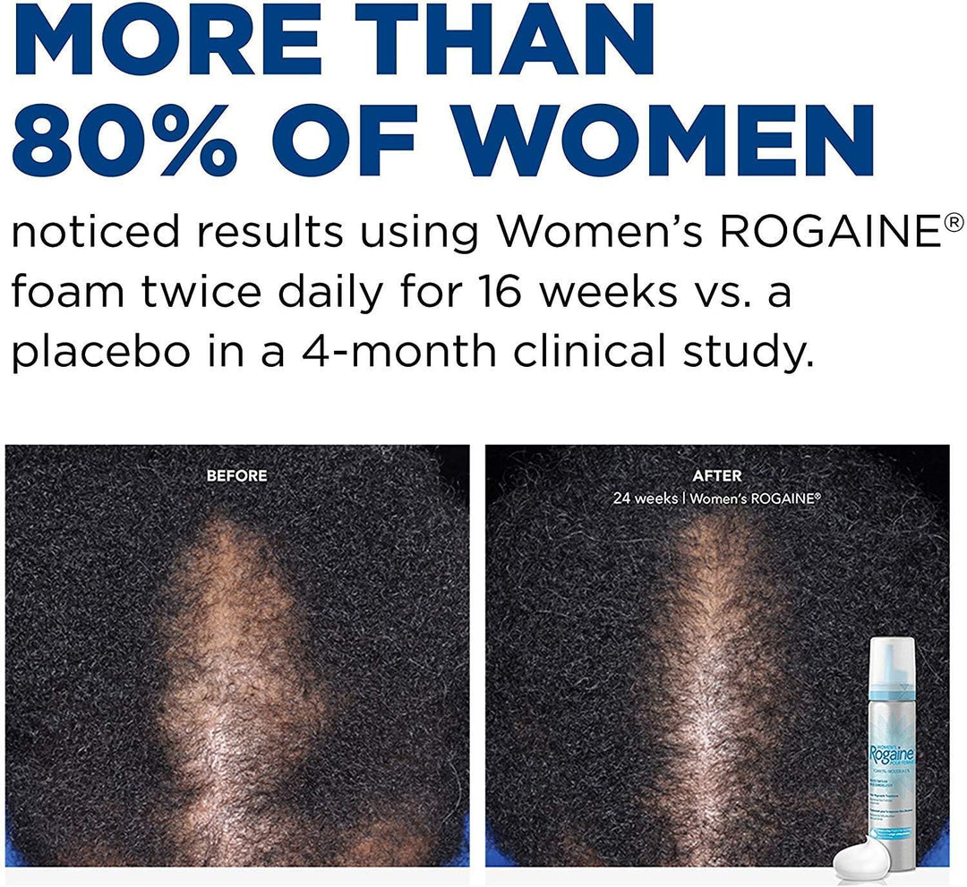 Rogaine - Espuma de minoxidil tópica al 5%, tratamiento contra la c...