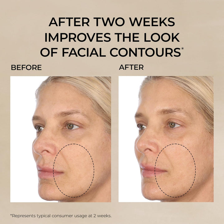 Cápsulas de suero facial de retinol + HPR de ceramidas de Elizabeth...