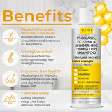 Champú antifúngico para psoriasis, eczema, champú para dermatitis s...
