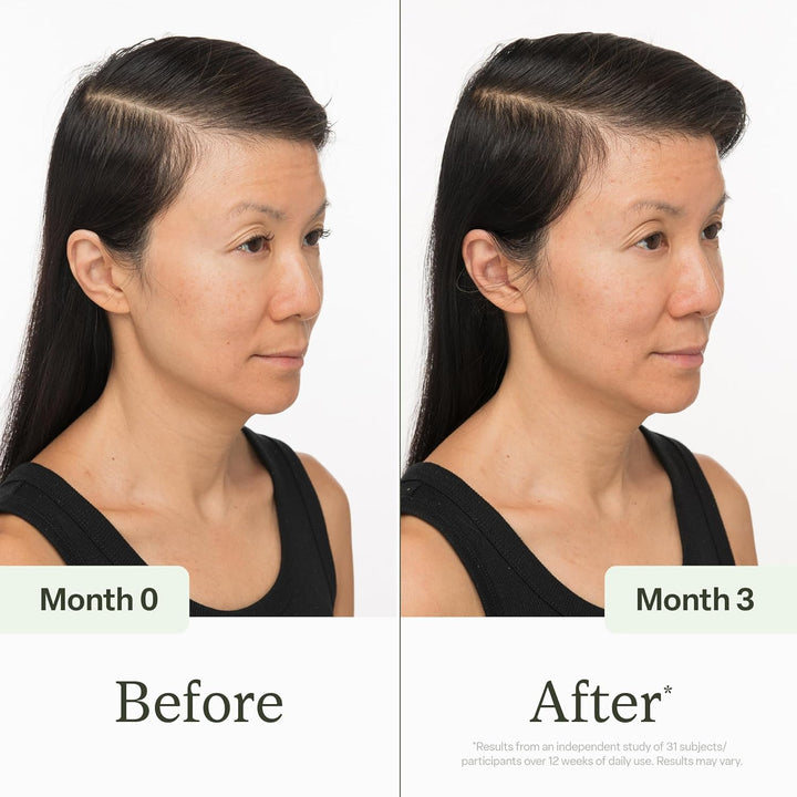 Divi Scalp Serum for Thinning Hair Clinically Tested, Non-Greasy Fo...