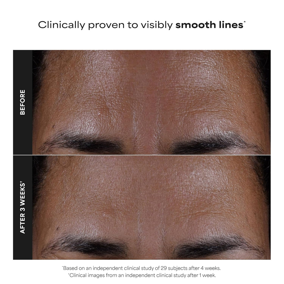 Paula's Choice Skin Perfecting - Exfoliante líquido de ácido sa...