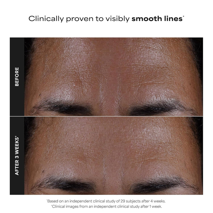 Paula's Choice Skin Perfecting - Exfoliante líquido de ácido sa...