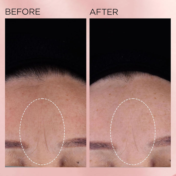 Cápsulas de suero facial de retinol + HPR de ceramidas de Elizabeth...
