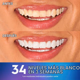 Crest 3D Whitestrips Efectos Profesionales + Luz LED \u2013 Kit de...