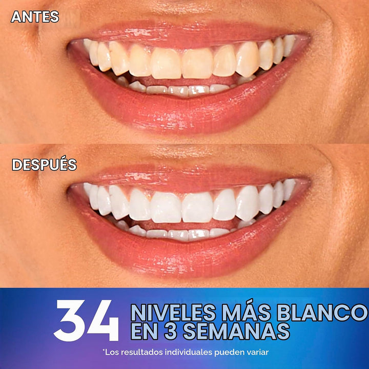 Crest 3D Whitestrips Efectos Profesionales + Luz LED \u2013 Kit de...