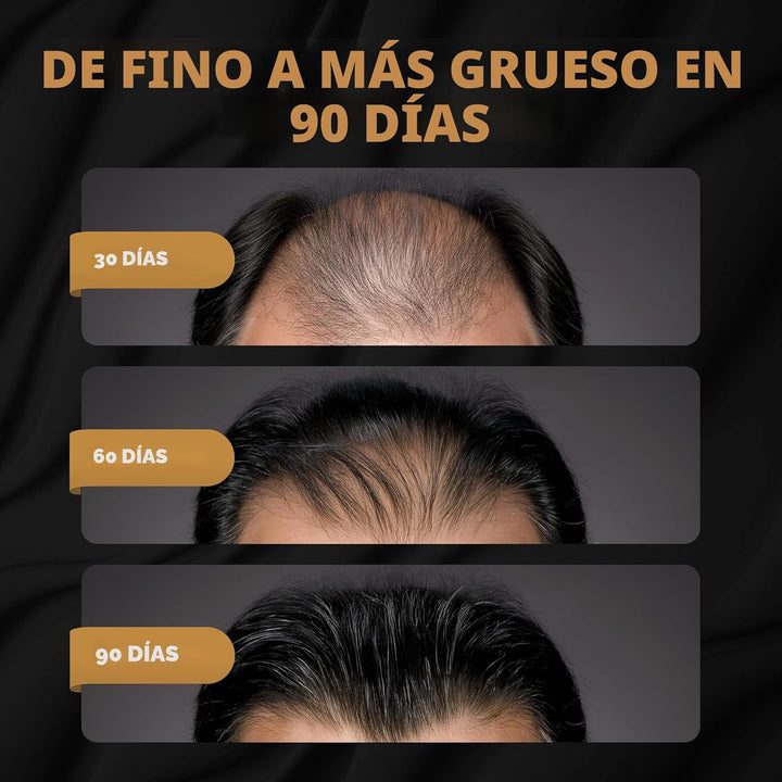 Champú Activador de Raíces SPARTAN™ para Hombres - Champú para el C...