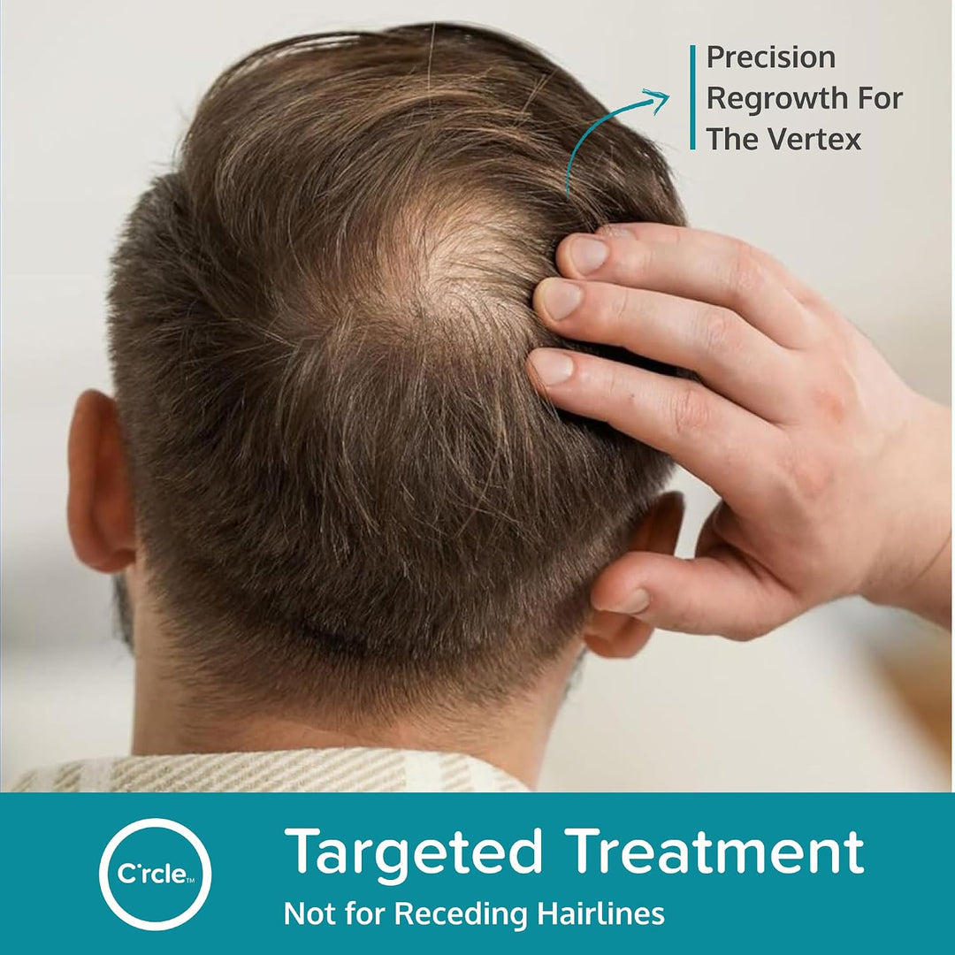 Regoxidine Men's 5% Minoxidil Foam ayuda a restaurar la pérdida...