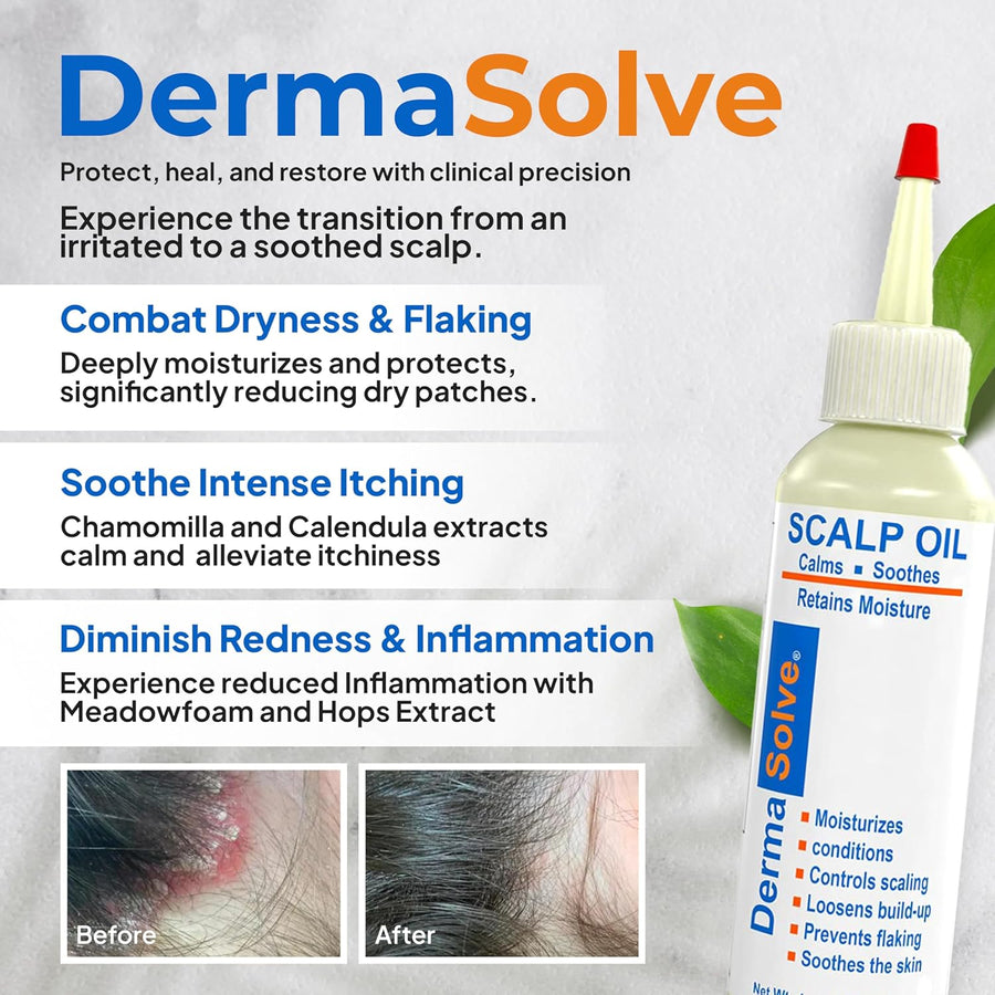Dermasolve Aceite de psoriasis y caspa, aprobado por dermatólogos p...
