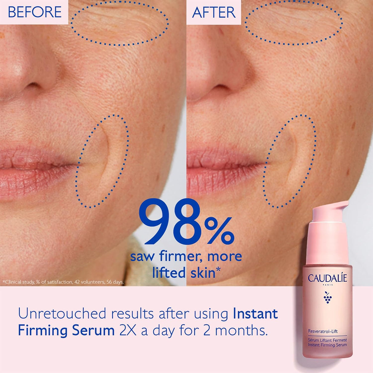 Caudalie Resveratrol-Lift Suero Alternativo Retinol Reafirmante Ins...