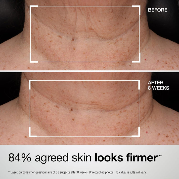 StriVectin Tighten and Lift Advanced Neck Cream PLUS with Alpha-3 P...