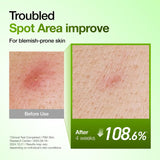 Anua Suero Facial de Ácido Azelaico 10% Hialurónico en Rojo Tranqui...