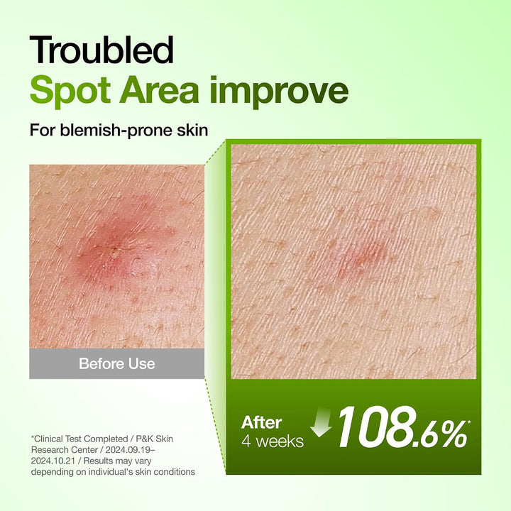 Anua Suero Facial de Ácido Azelaico 10% Hialurónico en Rojo Tranqui...