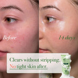 VELVENTE Matcha Rose PDRN - Jabón facial coreano, limpiador hidrata...