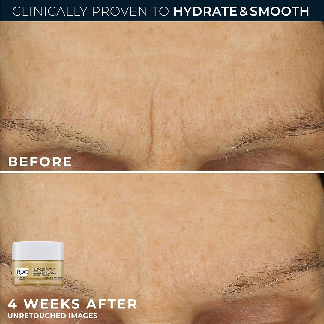RoC Clinical Mini Retinol Kit de rutina para el cuidado de la piel...