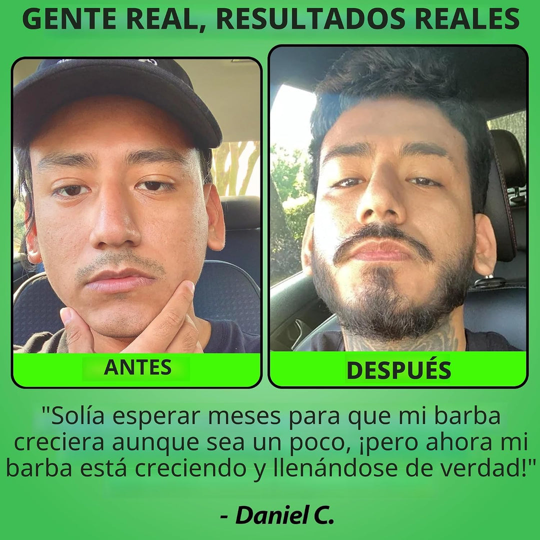 Minoxidil para el crecimiento de la barba: suero al 5% con 2 veces...