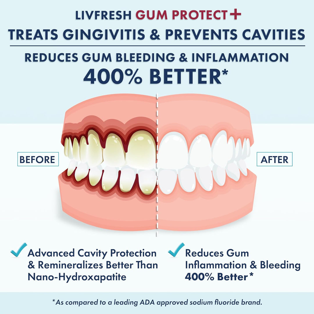 LIVFRESH Gum Protect - Gel de pasta de dientes, tratamiento de ging...
