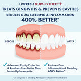 LIVFRESH Gum Protect - Gel de pasta de dientes, tratamiento de ging...