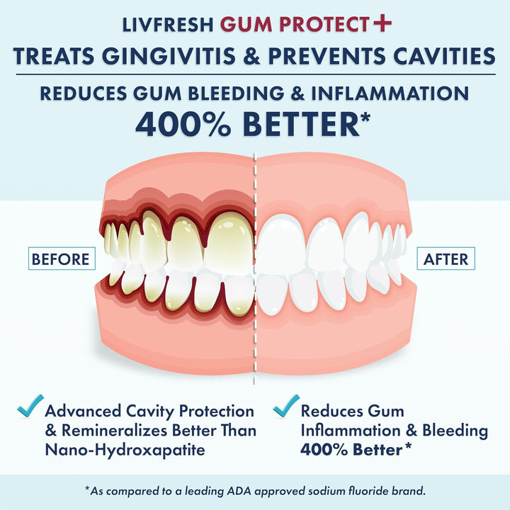 LIVFRESH Gum Protect - Gel de pasta de dientes, tratamiento de ging...