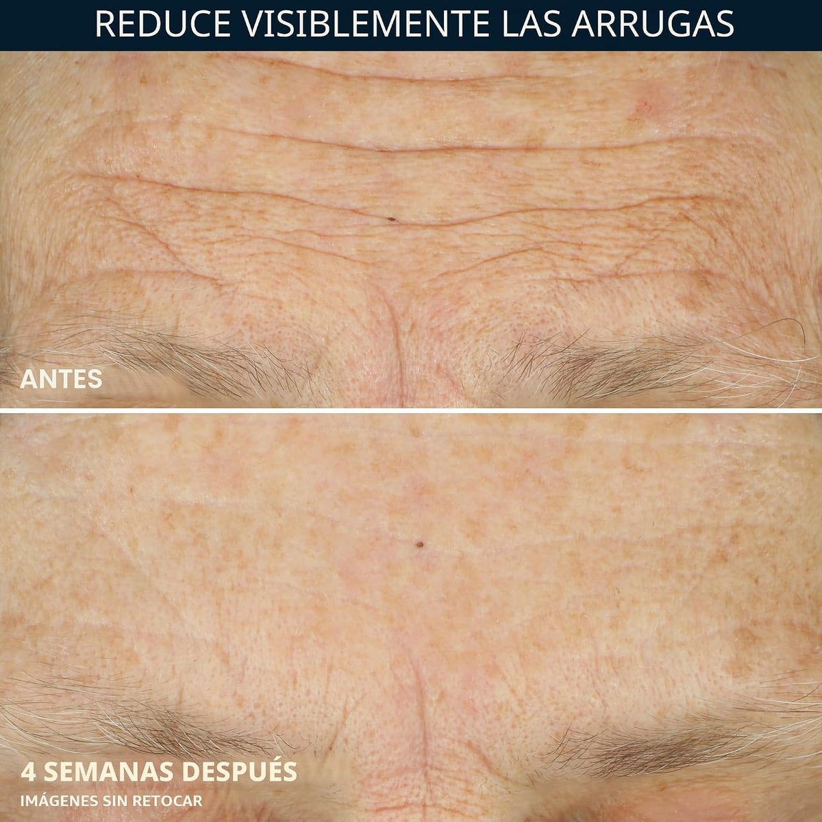 RoC Crema reparadora de arrugas antienvejecimiento diaria para cara...