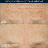 RoC Crema reparadora de arrugas antienvejecimiento diaria para cara...