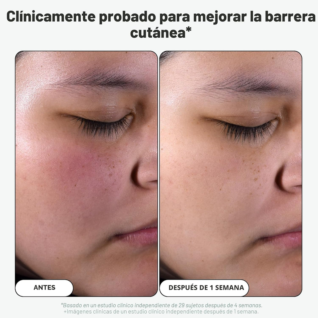 Paula's Choice Skin Perfecting - Exfoliante líquido de ácido sa...