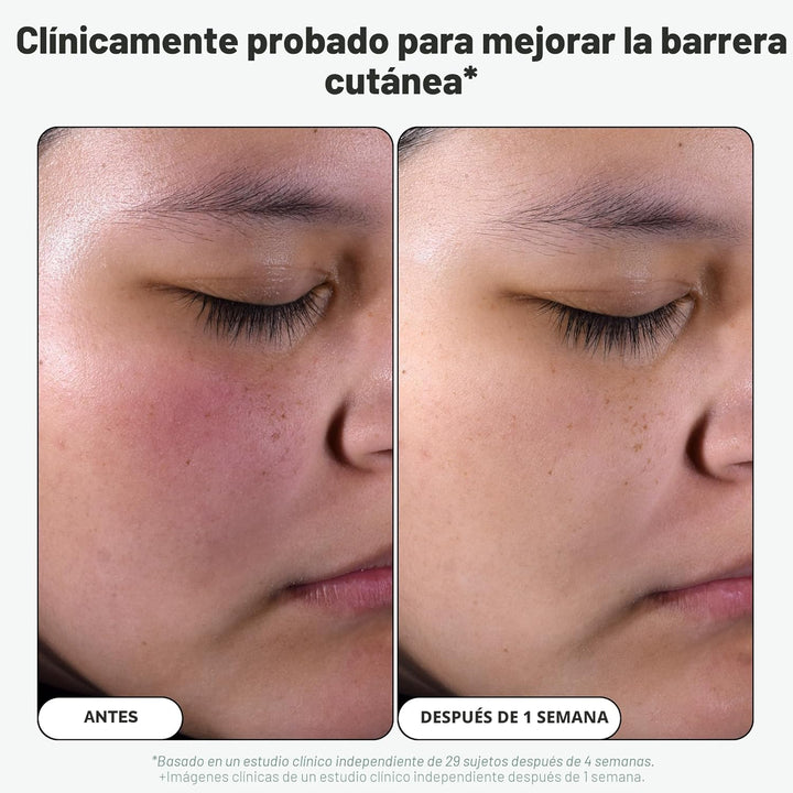 Paula's Choice Skin Perfecting - Exfoliante líquido de ácido sa...