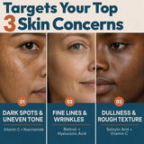 Suero de vitamina C Plus, 2 % retinol, 3,5 % niacinamida, 5 % ácido...