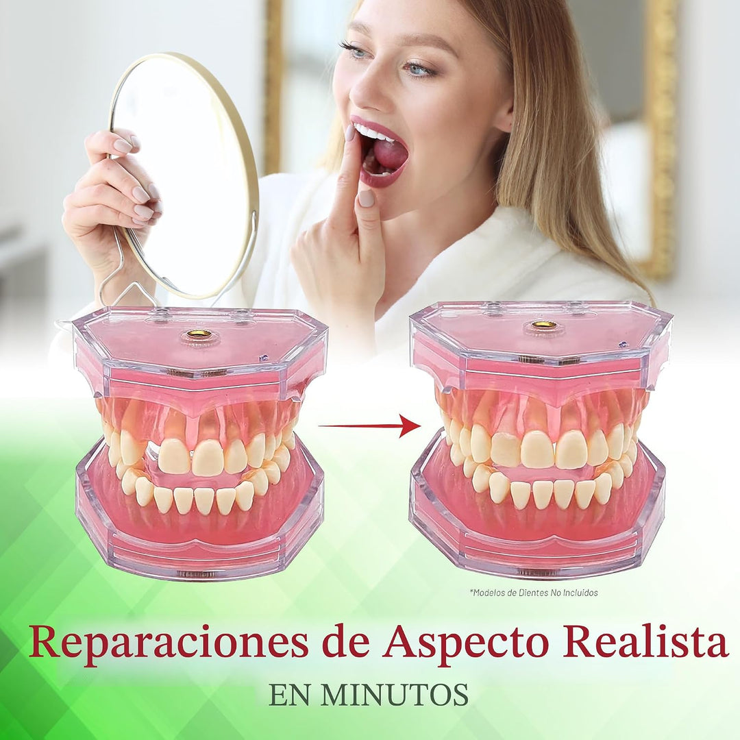 SmileFix Kit de reparación dental estándar - Compuesto de coloració...