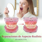 SmileFix Kit de reparación dental estándar - Compuesto de coloració...