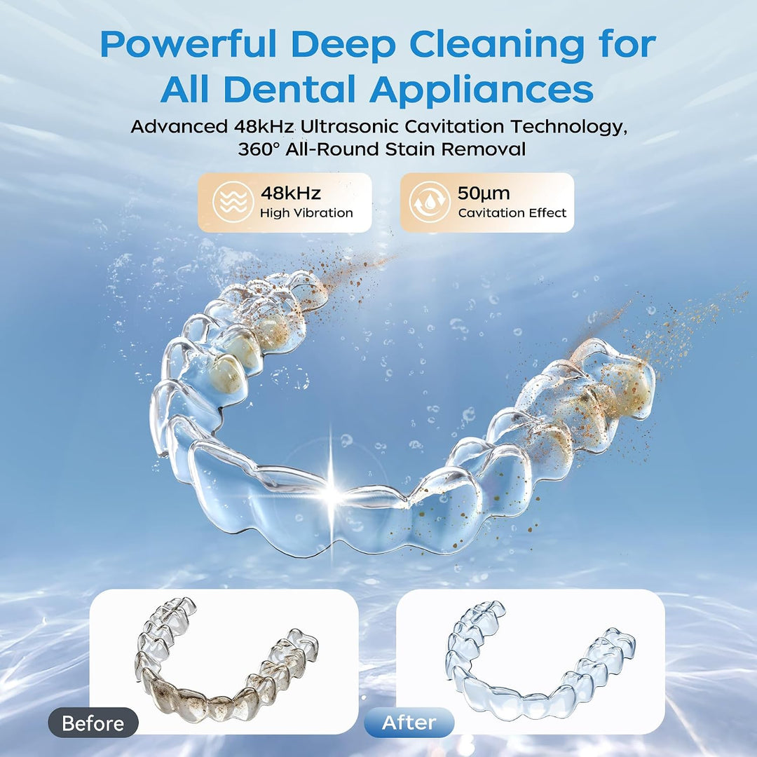 Máquina limpiadora de retenedores ultrasónica de 48 kHz, limpiador...
