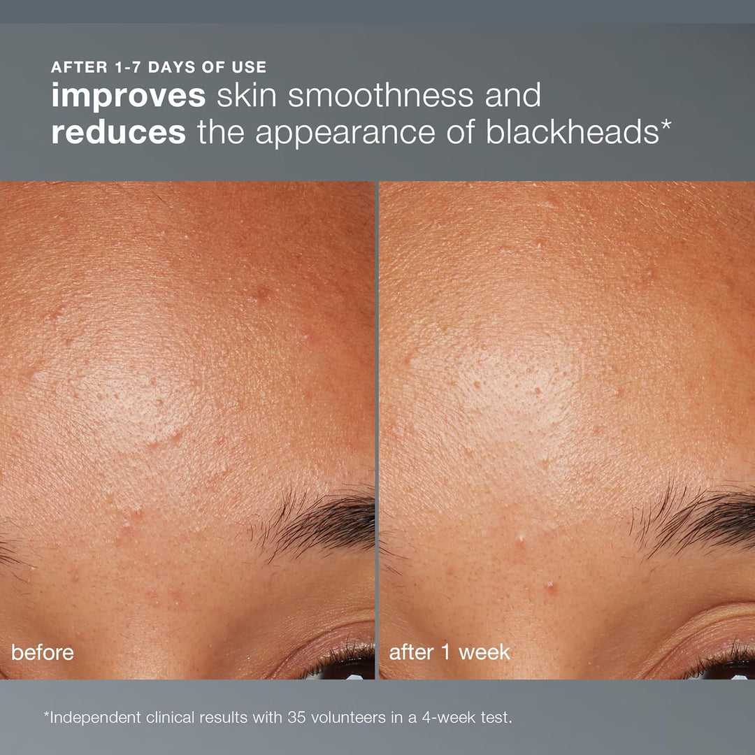 Dermalogica Exfoliante facial diario microfoliante con ácido salicí...