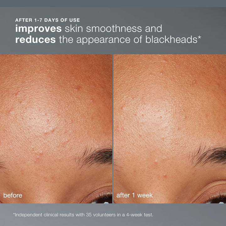 Dermalogica Exfoliante facial diario microfoliante con ácido salicí...