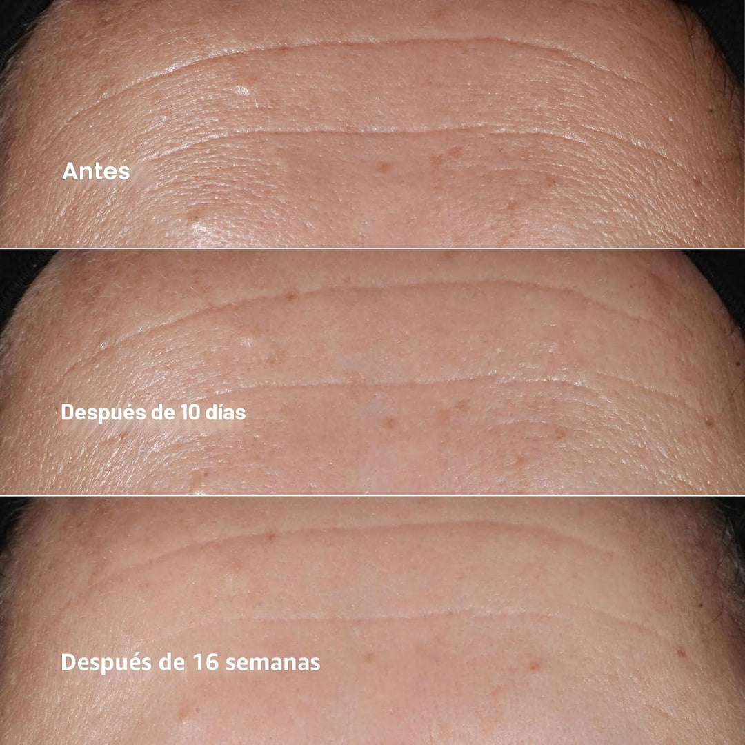Clinique Smart Clinical Repair Suero facial antienvejecimiento corr...