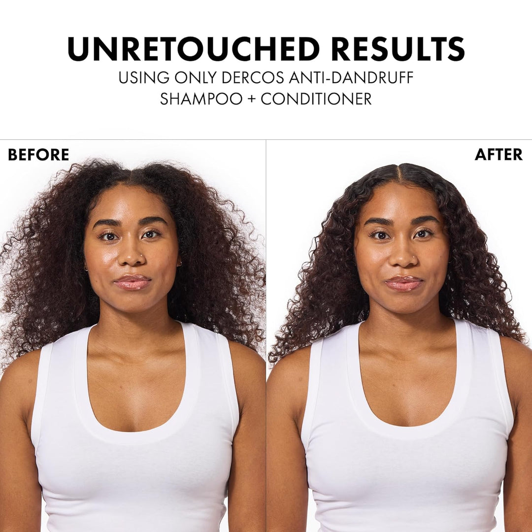 Dercos Dandruff Shampoo, Antifungal Dry Scalp Treatment &amp; Itchy...