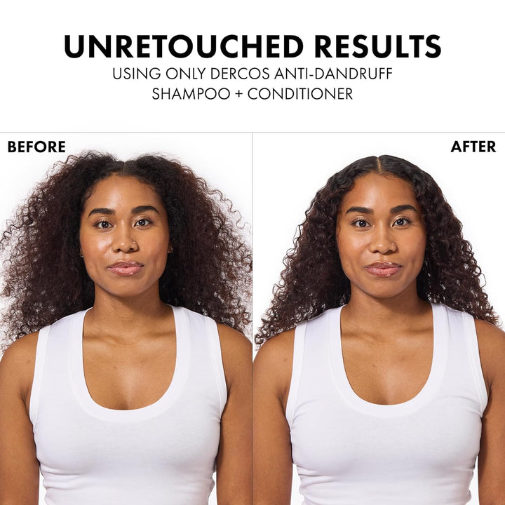 Dercos Dandruff Shampoo, Antifungal Dry Scalp Treatment &amp; Itchy...