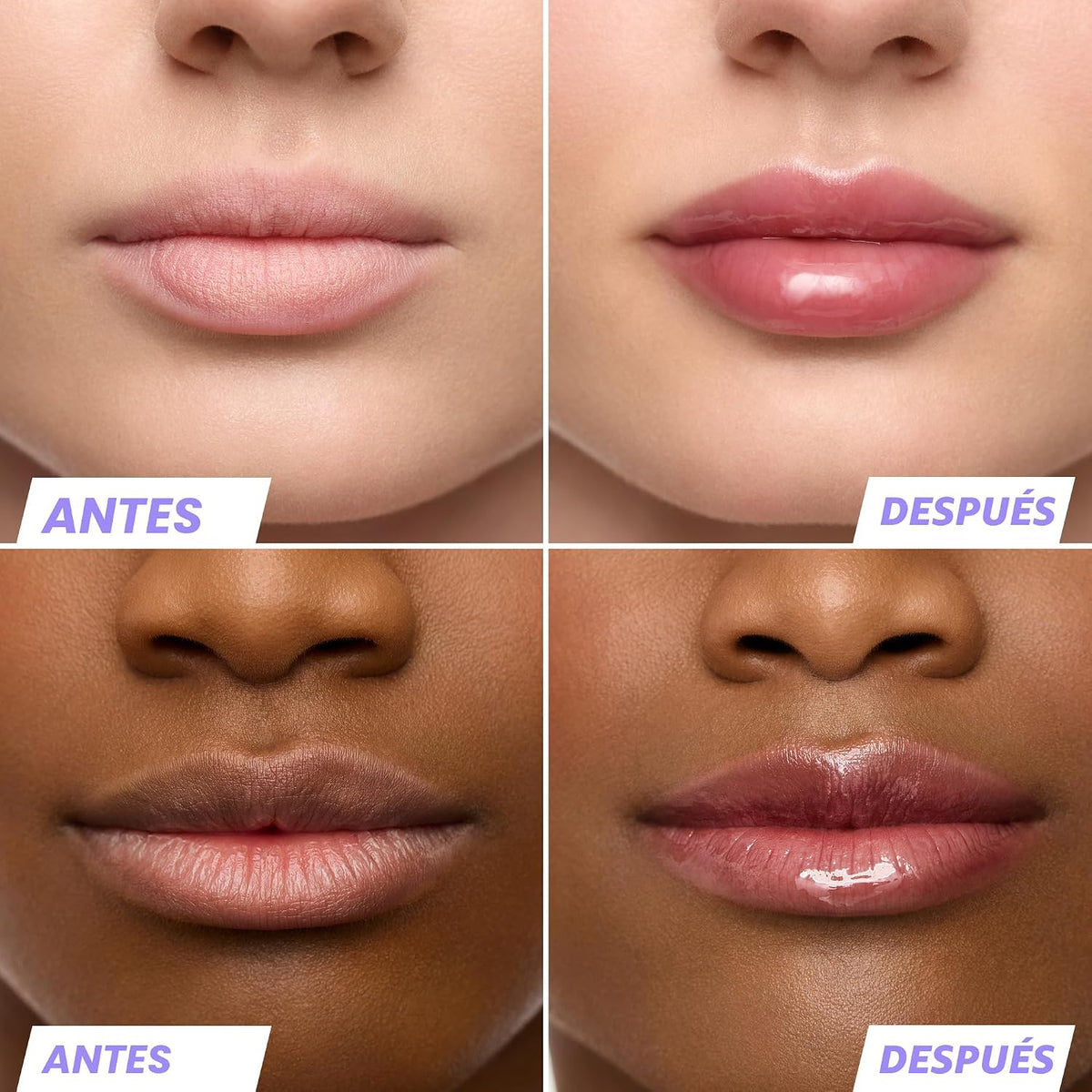Wonderskin - Suero de Rehabilitación de Aceite para Labios, Aceite...