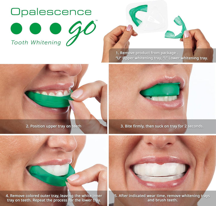 Opalescence Go - Bandejas de blanqueamiento dental precargadas con...