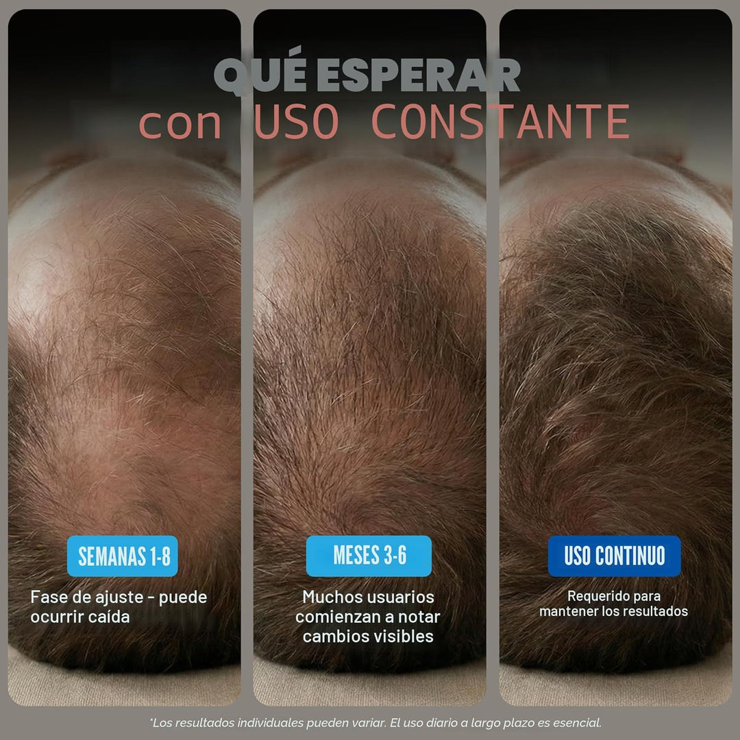 Minoxidil para hombres Paquete Líquido, Tratamiento de crecimiento...