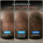 Minoxidil para hombres Paquete Líquido, Tratamiento de crecimiento...